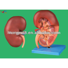 Piezas médicas PVC humano Modelo de riñón